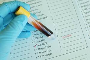 анализ крови на гепатит